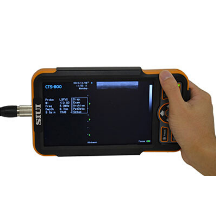 SIUI CTS-800 Портативный УЗИ аппарат для КРС и лошадей