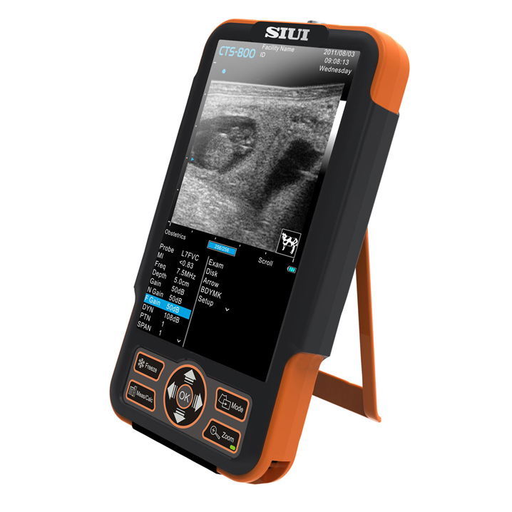 SIUI CTS-800 Портативный УЗИ аппарат для КРС и лошадей